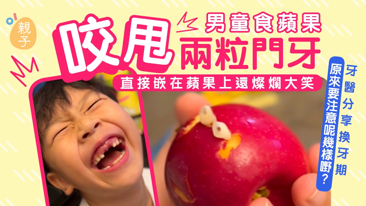 男童食蘋果咬甩兩粒門牙燦笑超可愛 家長必知換牙期注意事項 男童食蘋果咬甩兩粒門牙燦笑超可愛 家長必知換牙期注意事項