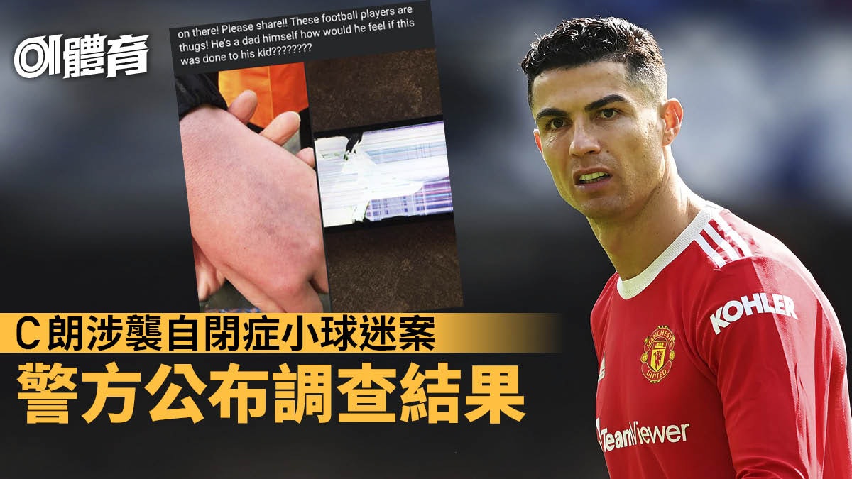 英超熱話|C朗襲小球迷案件作結 被當地警方有條件警告 英超熱話|C朗襲小球迷案件作結 被當地警方有條件警告