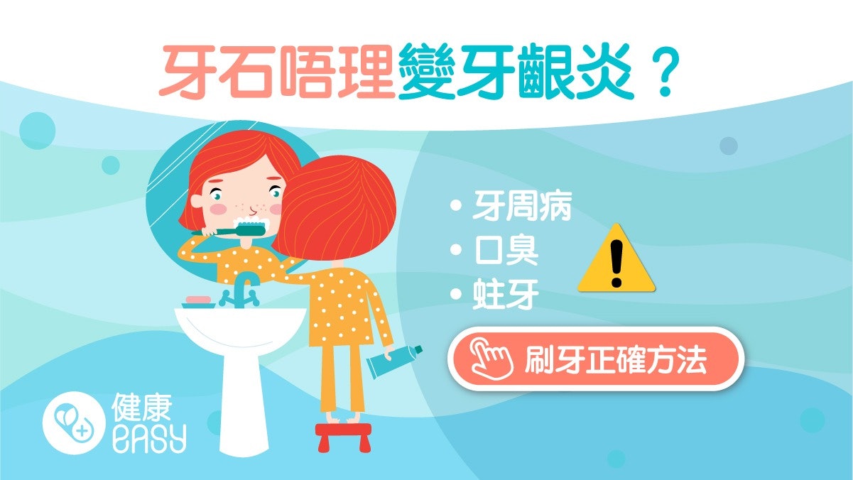 牙齒健康|搞懂牙石成因症狀不再口臭 治療與預防要這樣做 牙齒健康|搞懂牙石成因症狀不再口臭 治療與預防要這樣做