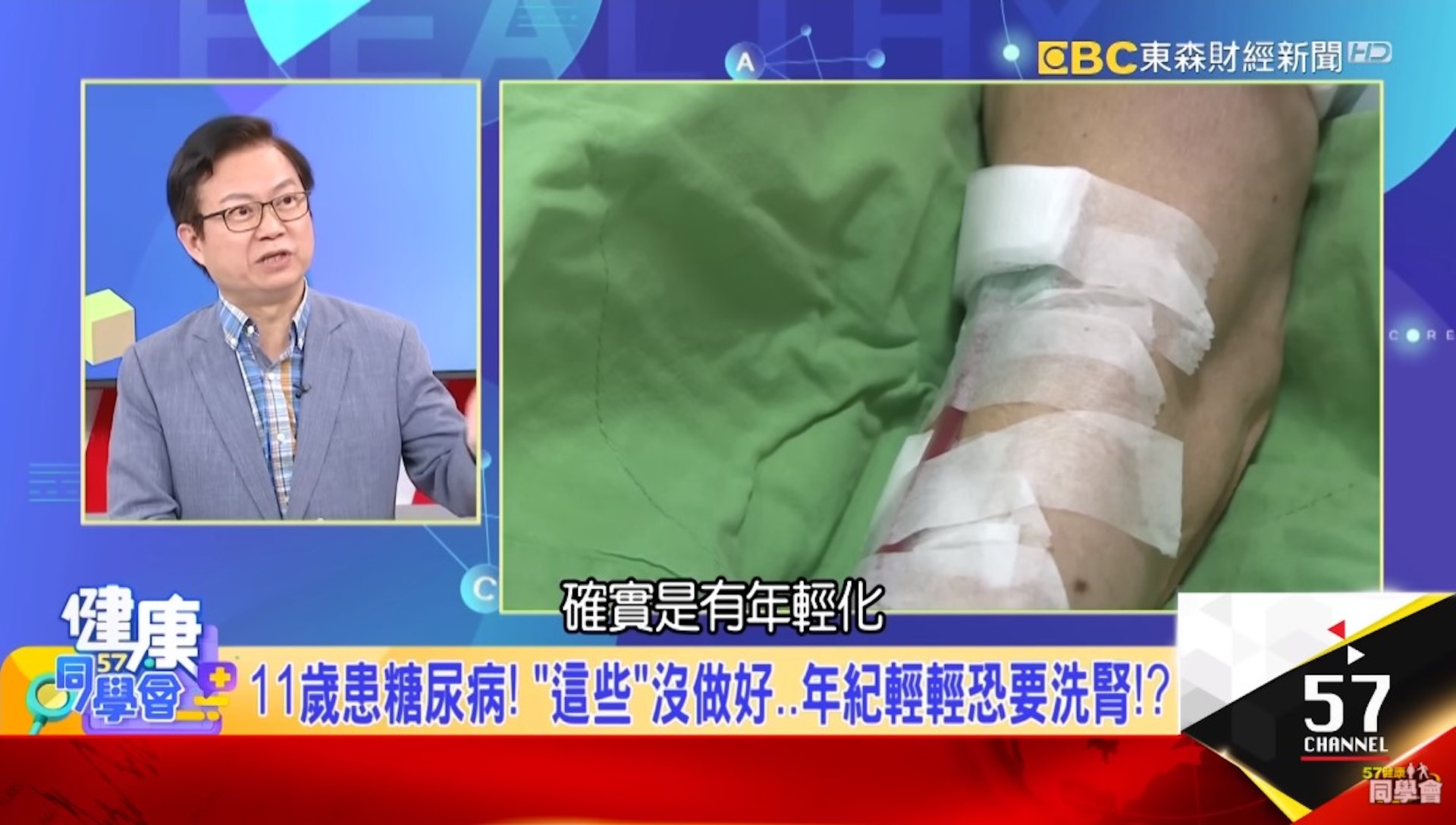 台灣在2018年的洗腎盛行率是全球第一,令不少人擔憂不已,亦增加了醫療開支。台灣肝膽腸胃科醫生蕭敦仁於節目《健康同學會》提出「護腎8寶」,希望民眾能減低患腎病的風險。(東森財經新聞《健康同學會》影片截圖) 台灣在2018年的洗腎盛行率是全球第一,令不少人擔憂不已,亦增加了醫療開支。台灣肝膽腸胃科醫生蕭敦仁於節目《健康同學會》提出「護腎8寶」,希望民眾能減低患腎病的風險。(東森財經新聞《健康同學會》影片截圖)