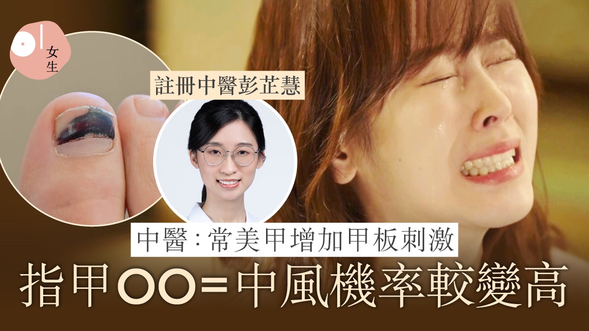 指甲反映4至18個月健康 月牙愈多愈好?中醫:常美甲損指甲健康 指甲反映4至18個月健康 月牙愈多愈好?中醫:常美甲損指甲健康
