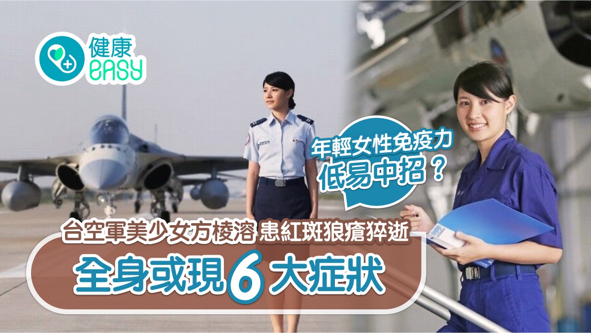 紅斑狼瘡｜台空軍美少女方棱溶病逝   6大症狀要知咩人最高危？