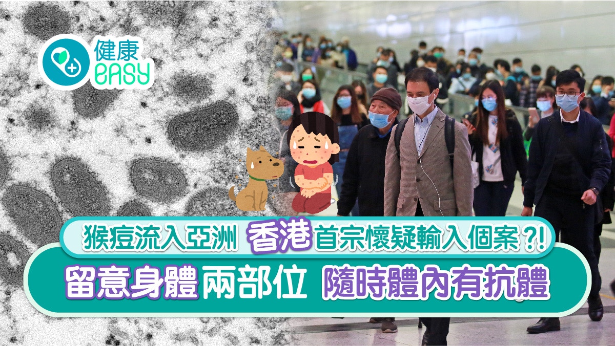 猴痘｜本港現首宗猴痘輸入個案　留意身體兩部位、體內隨時有抗體