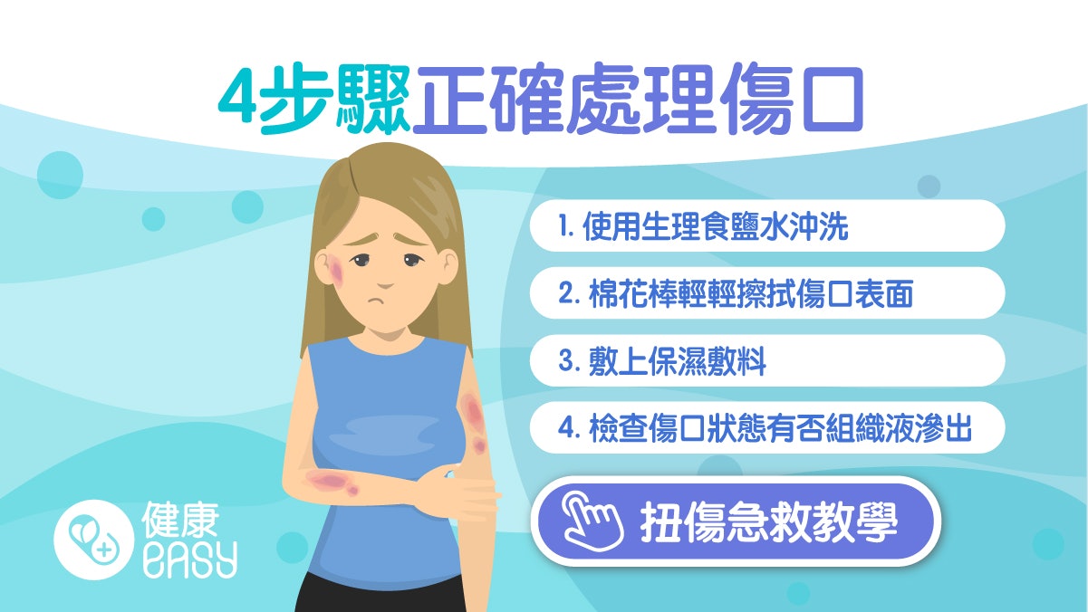傷口處理|用優碘消毒影響癒合?醫生教4步驟處理傷口不易留疤 傷口處理|用優碘消毒影響癒合?醫生教4步驟處理傷口不易留疤