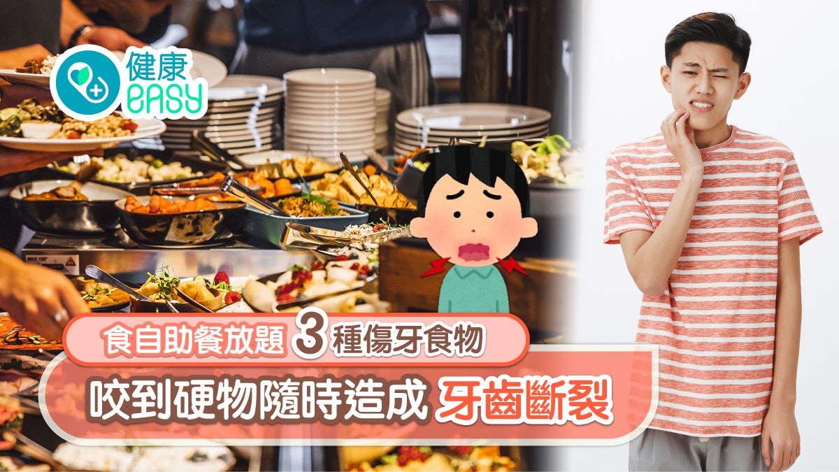 牙齒健康|食自助餐放題3種傷牙食物 咬到硬物隨時造成牙齒斷裂 牙齒健康|食自助餐放題3種傷牙食物 咬到硬物隨時造成牙齒斷裂