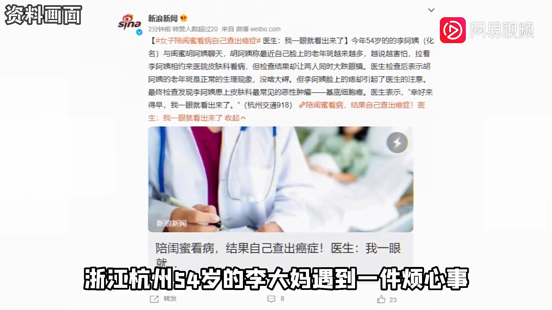 大陸一名李姓婦人(54歲)陪閨密去看皮膚科,結果閨密的老人斑沒事。反倒是自己身上的痣被醫生看出問題,進一步檢查竟發現罹患「基底細胞癌」,幸好手術後恢復良好。(網易視頻截圖) 大陸一名李姓婦人(54歲)陪閨密去看皮膚科,結果閨密的老人斑沒事。反倒是自己身上的痣被醫生看出問題,進一步檢查竟發現罹患「基底細胞癌」,幸好手術後恢復良好。(網易視頻截圖)