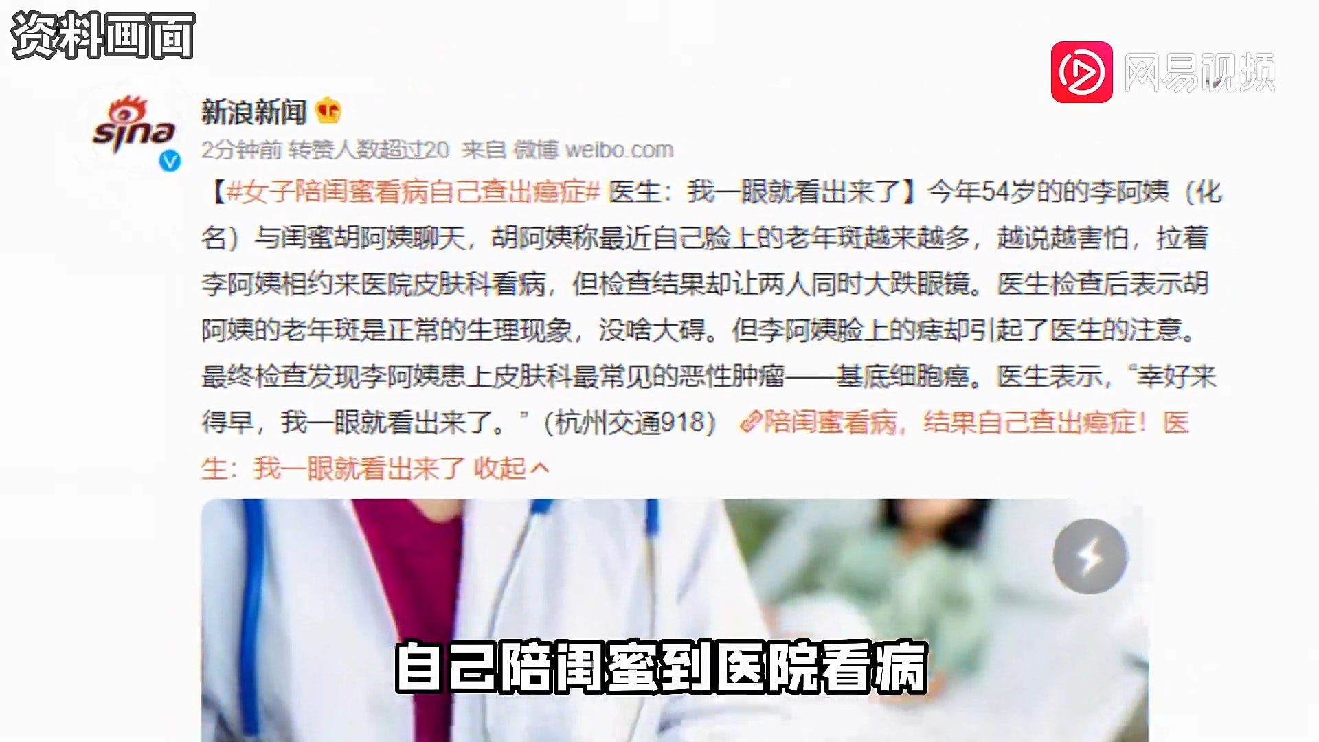 大陸一名李姓婦人（54歲）陪閨密去看皮膚科，結果閨密的老人斑沒事。反倒是自己身上的痣被醫生看出問題，進一步檢查竟發現罹患「基底細胞癌」，幸好手術後恢復良好。（網易視頻截圖）