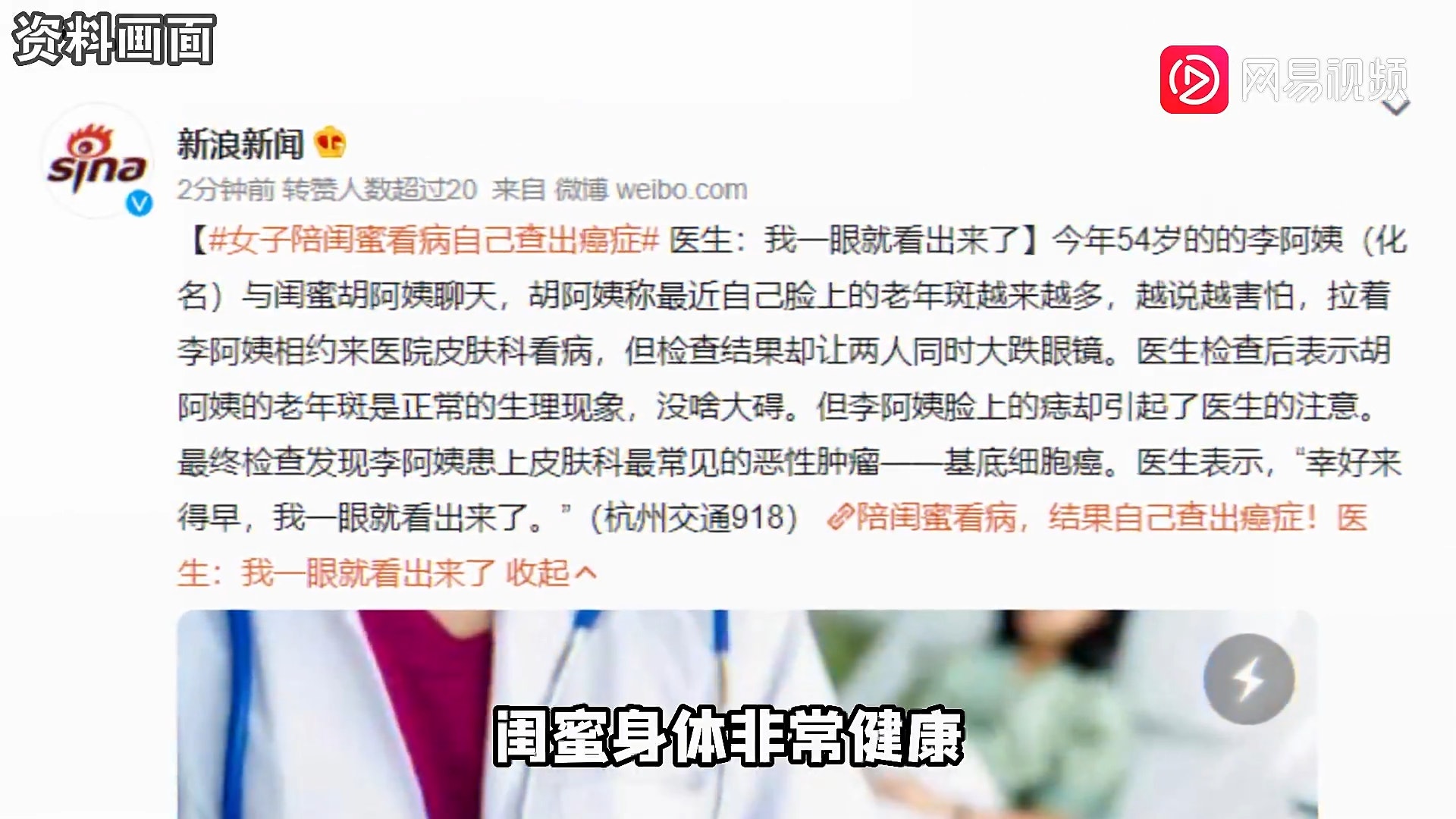 大陸一名李姓婦人(54歲)陪閨密去看皮膚科,結果閨密的老人斑沒事。反倒是自己身上的痣被醫生看出問題,進一步檢查竟發現罹患「基底細胞癌」,幸好手術後恢復良好。(網易視頻截圖) 大陸一名李姓婦人(54歲)陪閨密去看皮膚科,結果閨密的老人斑沒事。反倒是自己身上的痣被醫生看出問題,進一步檢查竟發現罹患「基底細胞癌」,幸好手術後恢復良好。(網易視頻截圖)