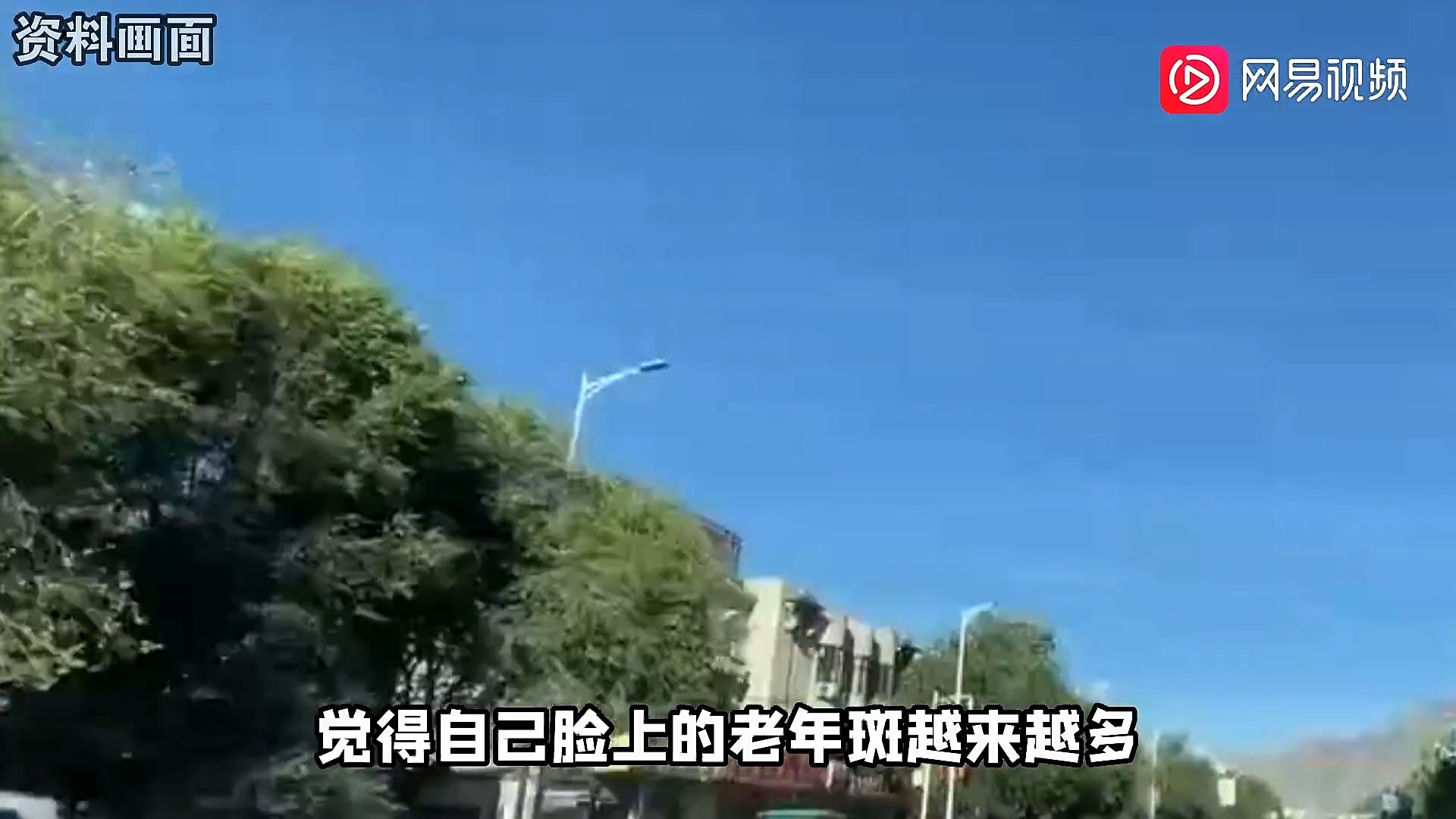 大陸一名李姓婦人(54歲)陪閨密去看皮膚科,結果閨密的老人斑沒事。反倒是自己身上的痣被醫生看出問題,進一步檢查竟發現罹患「基底細胞癌」,幸好手術後恢復良好。(網易視頻截圖) 大陸一名李姓婦人(54歲)陪閨密去看皮膚科,結果閨密的老人斑沒事。反倒是自己身上的痣被醫生看出問題,進一步檢查竟發現罹患「基底細胞癌」,幸好手術後恢復良好。(網易視頻截圖)