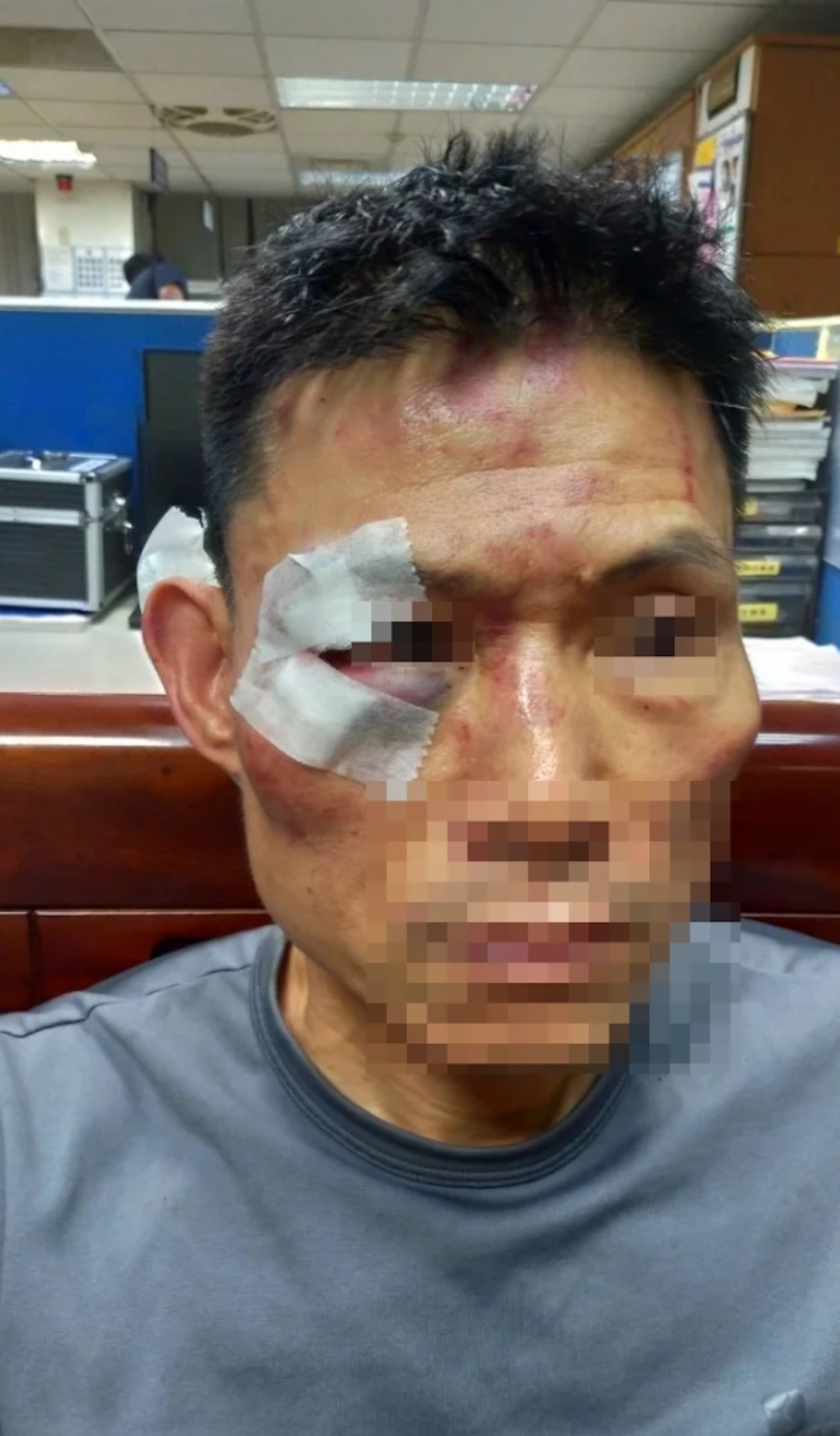 台灣新北市三重警分局二名員警20日晚埋伏抓通緝犯,錯將黃男認成通緝犯,導致黃男「拒捕」反抗受傷,造成黃男臉部縫了多針、肢體多處擦挫傷,怒控員警施暴,提告傷害、妨害自由、強制。(聯合新聞網) 台灣新北市三重警分局二名員警20日晚埋伏抓通緝犯,錯將黃男認成通緝犯,導致黃男「拒捕」反抗受傷,造成黃男臉部縫了多針、肢體多處擦挫傷,怒控員警施暴,提告傷害、妨害自由、強制。(聯合新聞網)