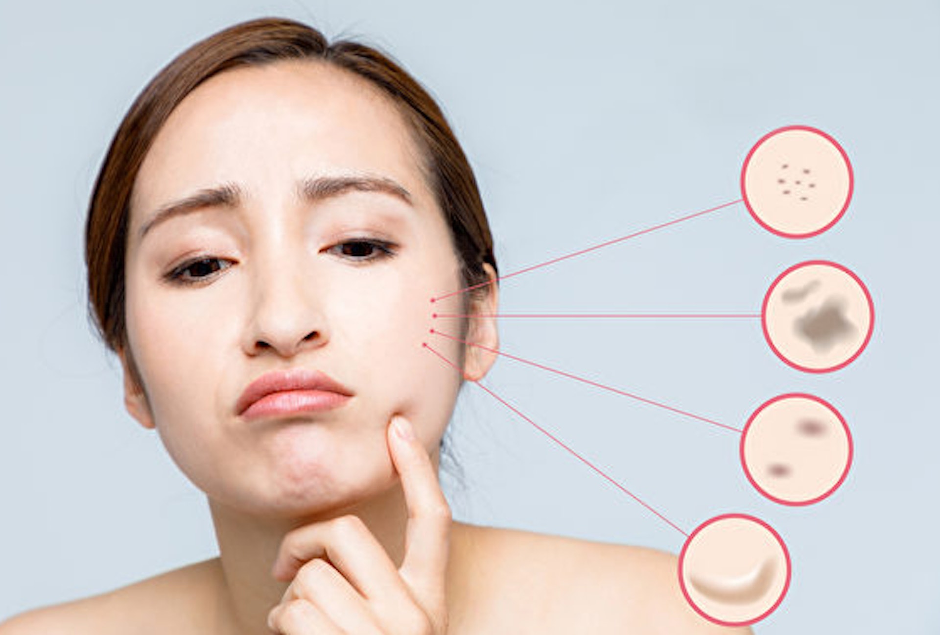 頑固的色斑往往十分棘手,令一眾愛美的女士困擾不已。(圖片:Shutterstock) 頑固的色斑往往十分棘手,令一眾愛美的女士困擾不已。(圖片:Shutterstock)