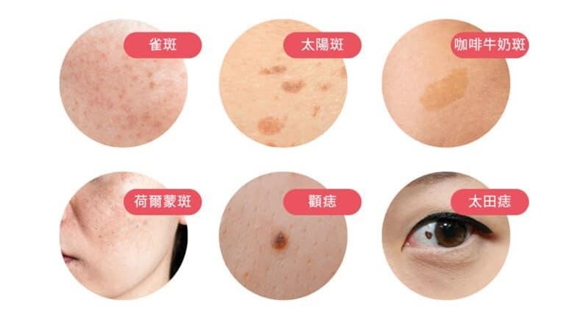 不同波長針對的色斑類型也有分別。(圖片:JC Beauty) 不同波長針對的色斑類型也有分別。(圖片:JC Beauty)