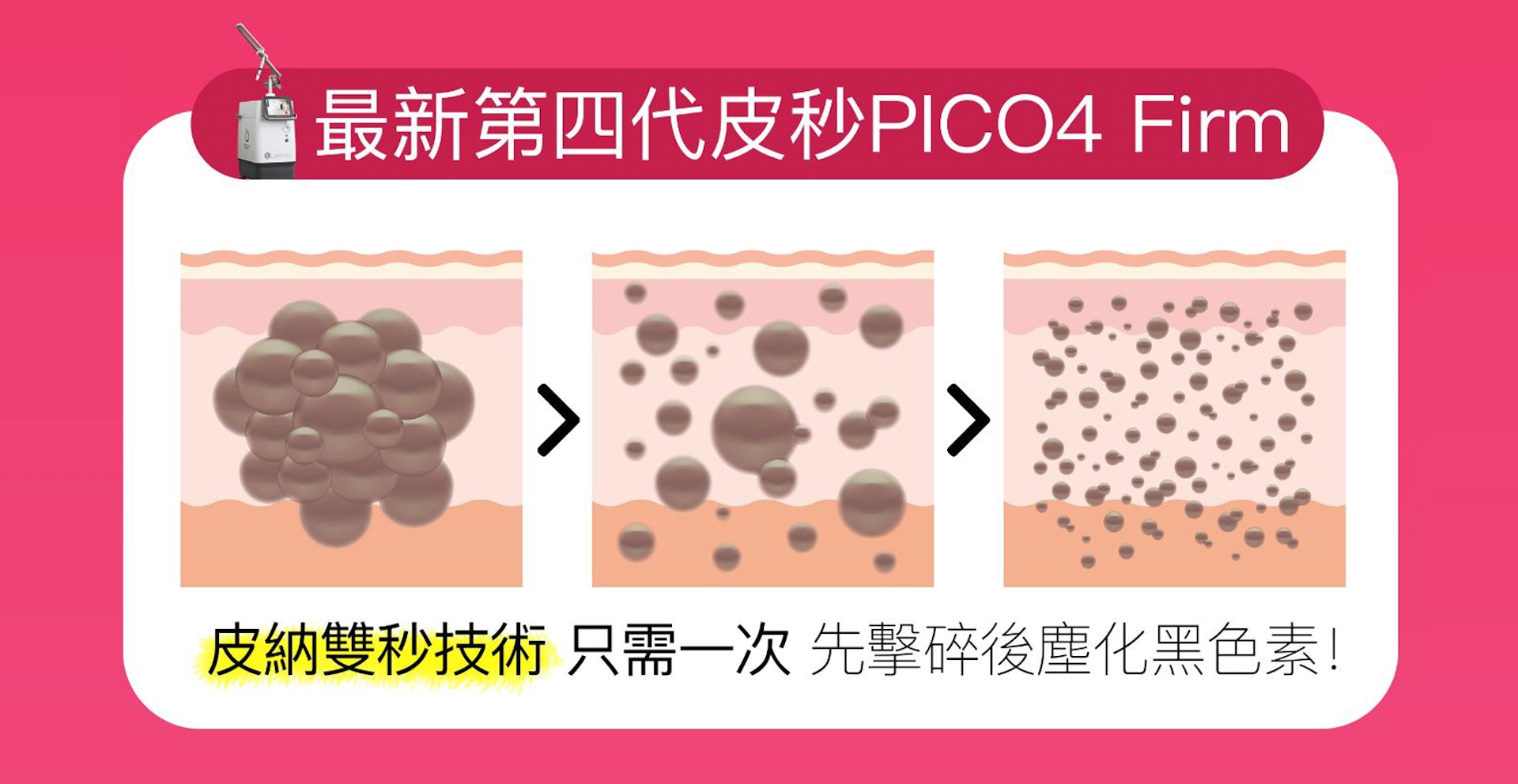 最新第4代皮秒 PICO4 Firm 採用二合一「皮納雙秒激光技術」，納秒、皮秒雙重夾擊，輕鬆狙擊全面的深淺層斑及色素。（圖片：JC Beauty）