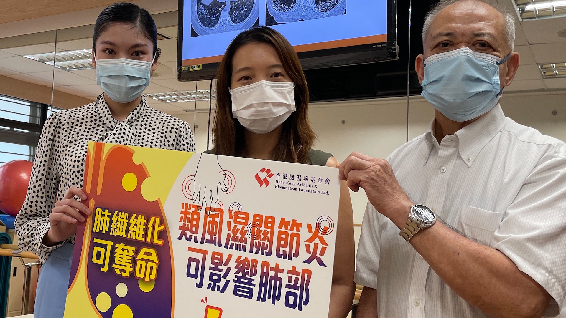 類風濕性關節炎只會影響關節? 小心患上併發肺纖維化 類風濕性關節炎只會影響關節? 小心患上併發肺纖維化