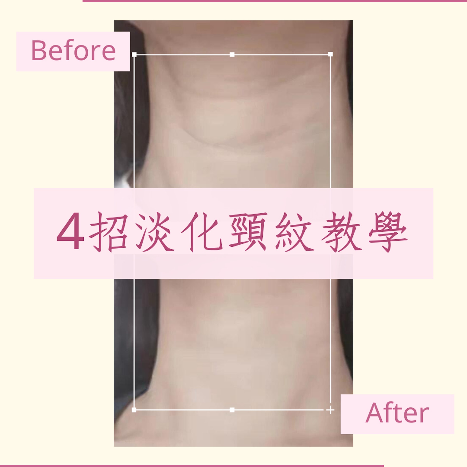 4招淡化頸紋教學(微博@竹苑O小鱼;01製圖) 4招淡化頸紋教學(微博@竹苑O小鱼;01製圖)