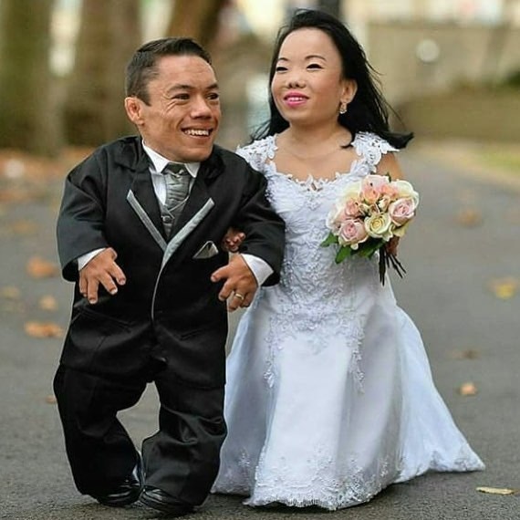 巴西侏儒症夫妻無懼歧視目光享幸福人生力證愛情不受身高所限制