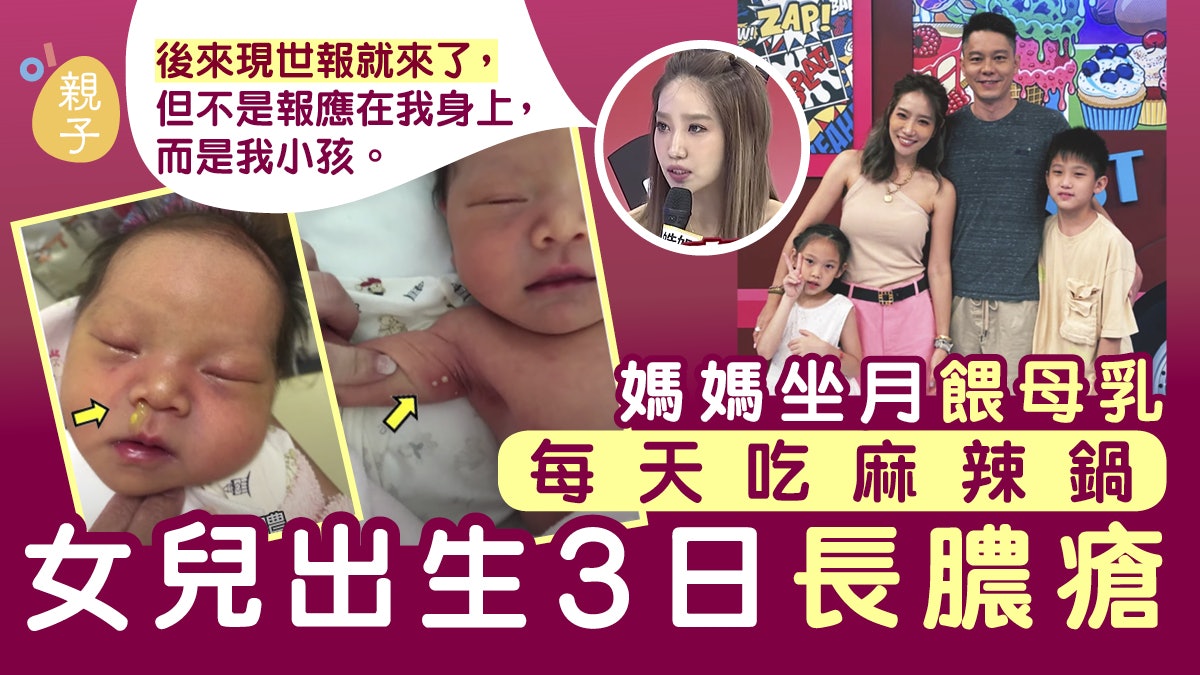 媽媽坐月餵母乳每天吃麻辣鍋 女兒出生3日長膿瘡 媽媽坐月餵母乳每天吃麻辣鍋 女兒出生3日長膿瘡