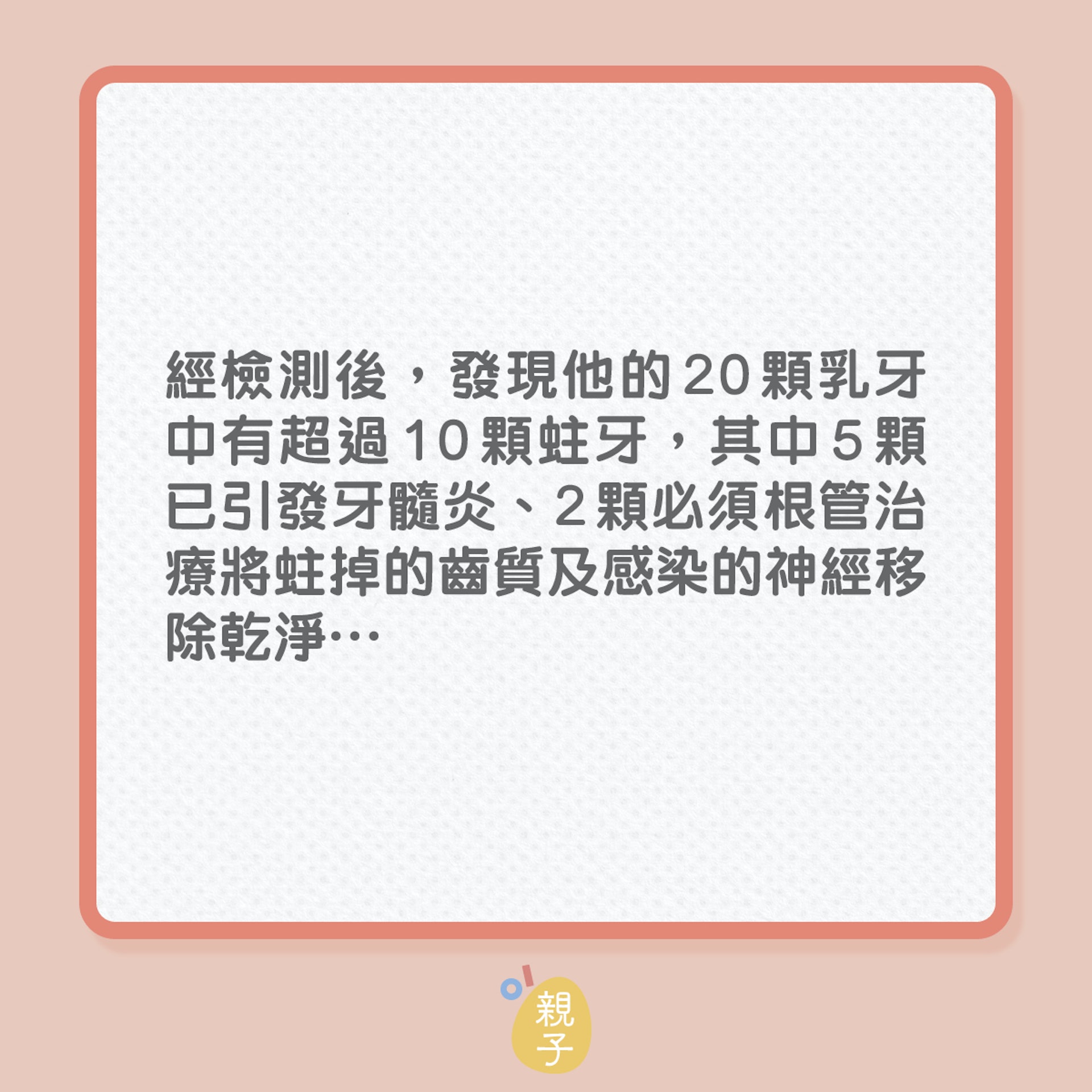 兒童健康|5歲男童,20隻乳齒竟有一半蛀了!(01製圖) 兒童健康|5歲男童,20隻乳齒竟有一半蛀了!(01製圖)