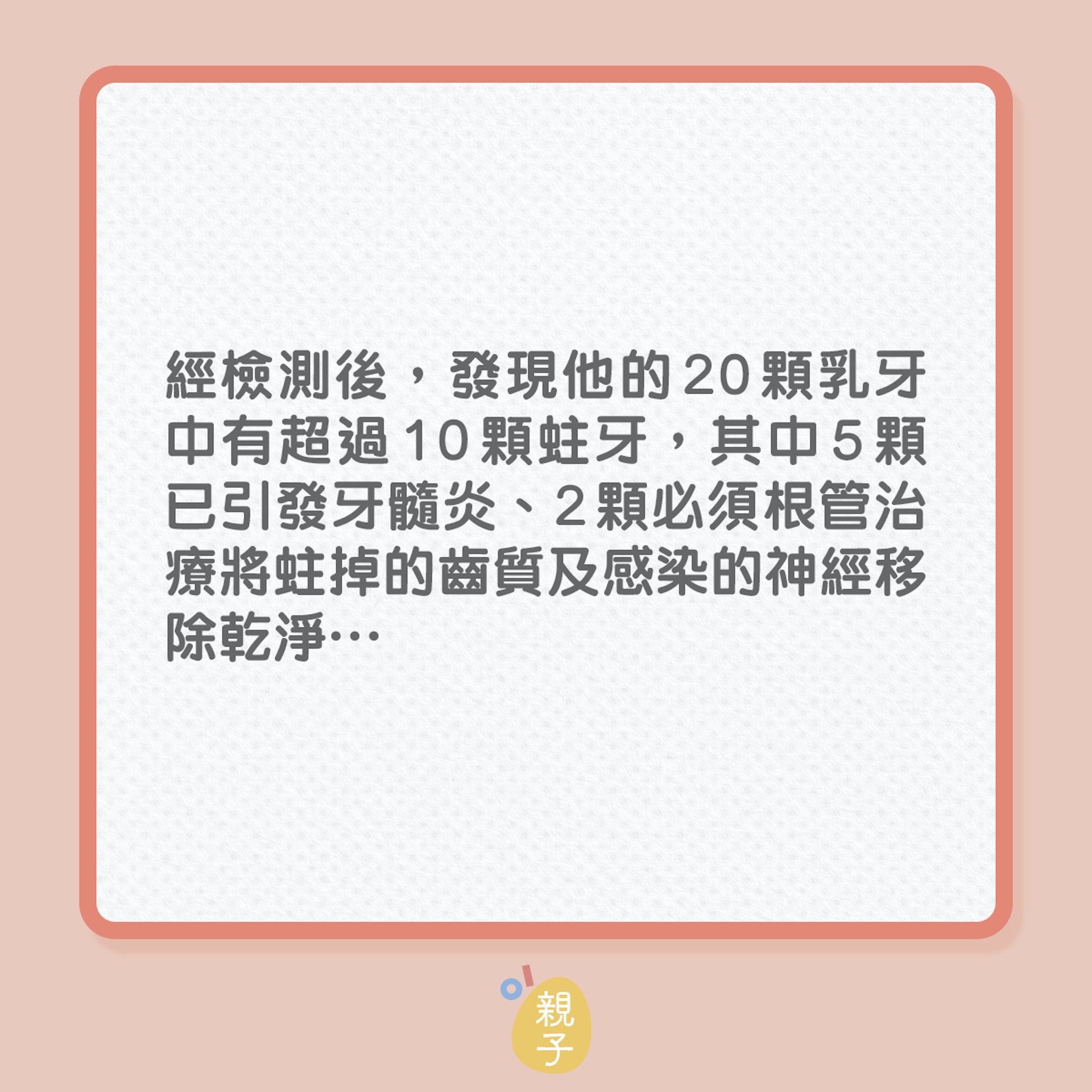 兒童健康｜5歲男童，20隻乳齒竟有一半蛀了！（01製圖）