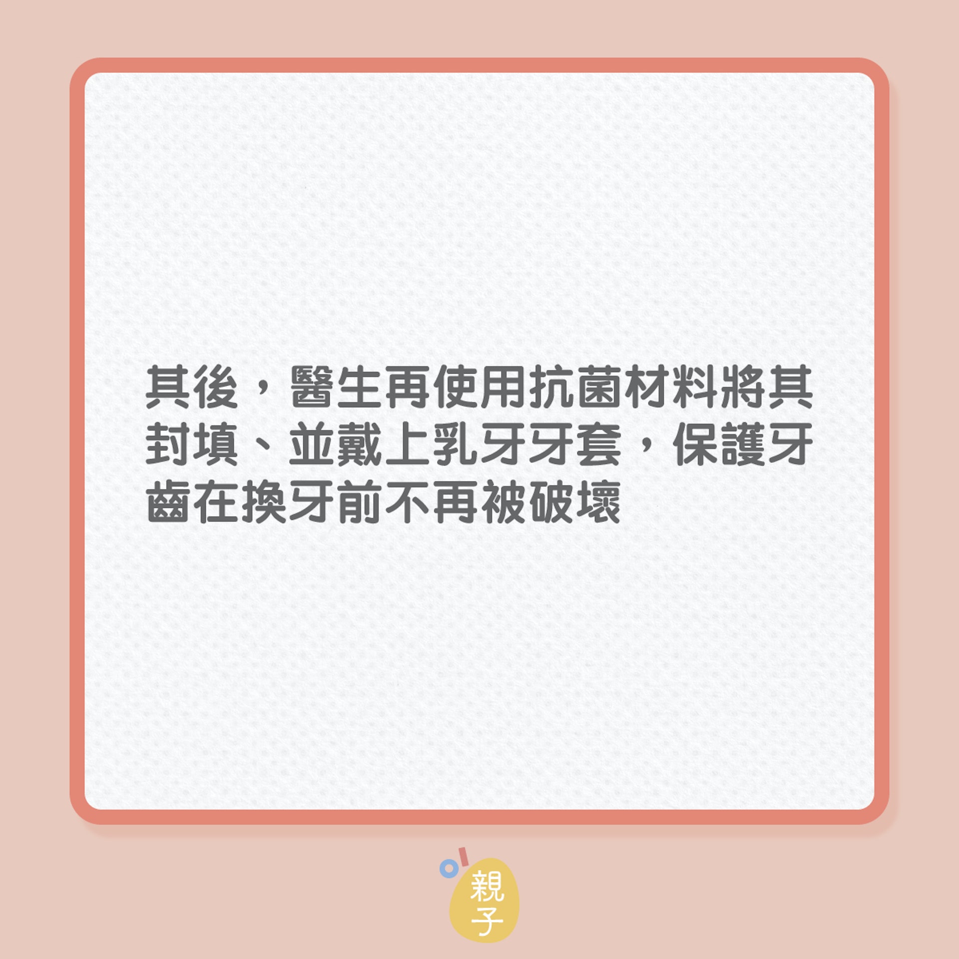 兒童健康|5歲男童,20隻乳齒竟有一半蛀了!(01製圖) 兒童健康|5歲男童,20隻乳齒竟有一半蛀了!(01製圖)