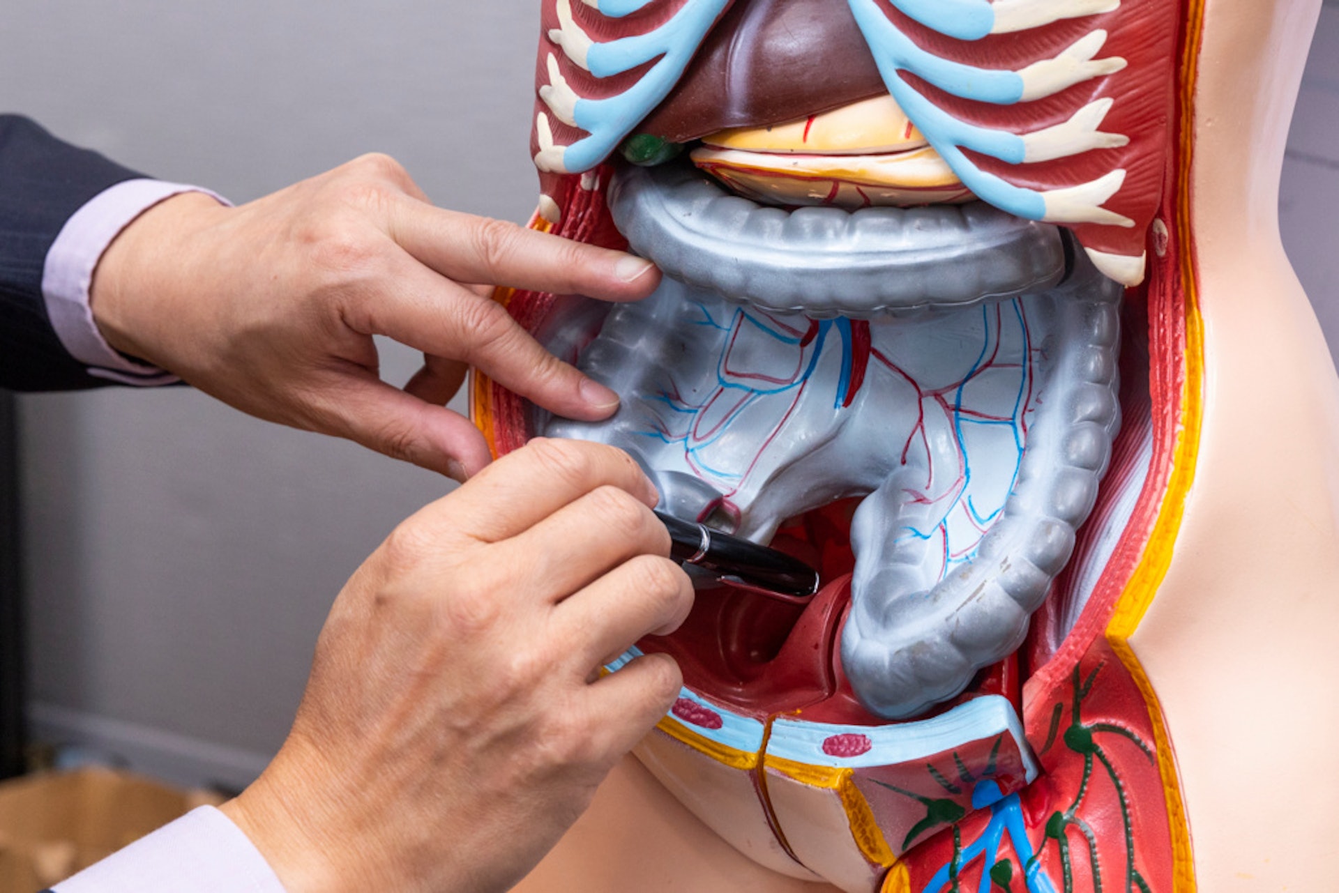 原發性腹膜癌並不常見,更多為腹腔轉移。由於腹腔轉移的腫瘤數以百計,細小的腫瘤亦難以看到,過往認為難以靠外科手術完全切除,只能進行紓緩性治療。 原發性腹膜癌並不常見,更多為腹腔轉移。由於腹腔轉移的腫瘤數以百計,細小的腫瘤亦難以看到,過往認為難以靠外科手術完全切除,只能進行紓緩性治療。