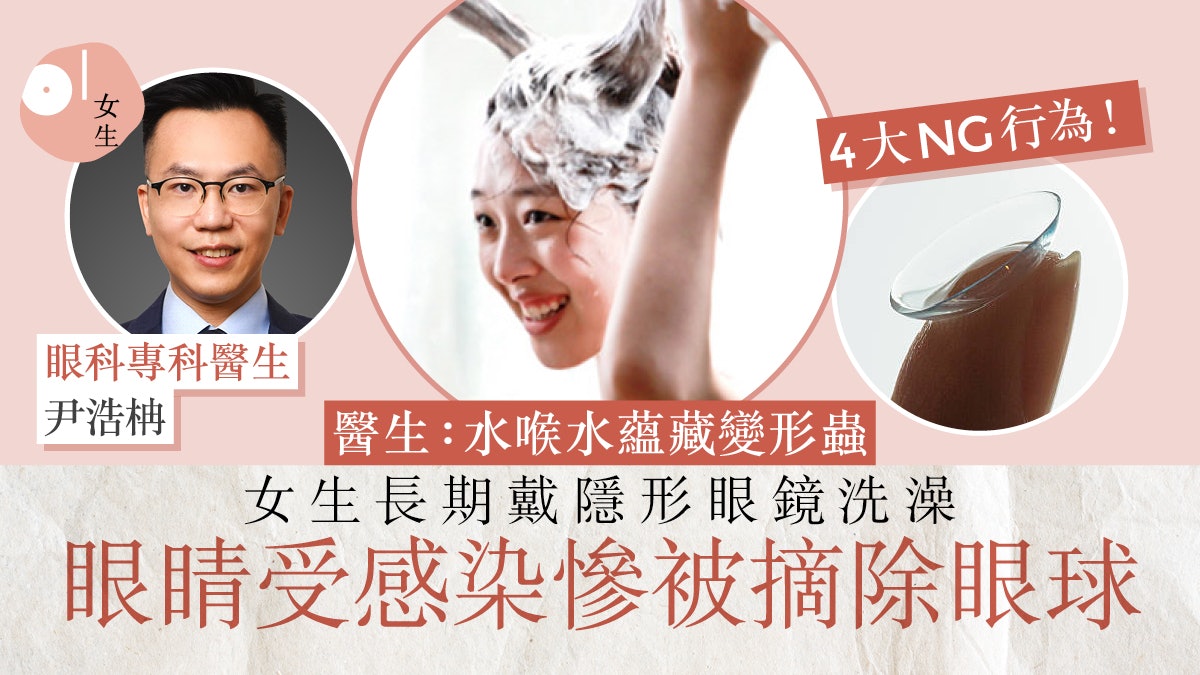 常戴Con洗澡受感染慘被摘除眼球 專家:熱水影響隱形眼鏡弧度