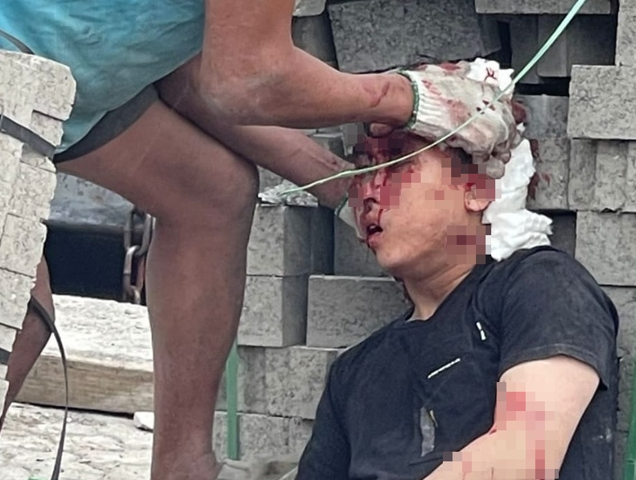 嘉俊被磚頭擊中頭破血流，工友替他按住傷口。（讀者提供）