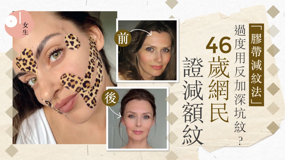 你夠美了嗎?歐美爆紅「膠帶減紋法」顯年輕 卻是糖衣包裝毒藥? 你夠美了嗎?歐美爆紅「膠帶減紋法」顯年輕 卻是糖衣包裝毒藥?