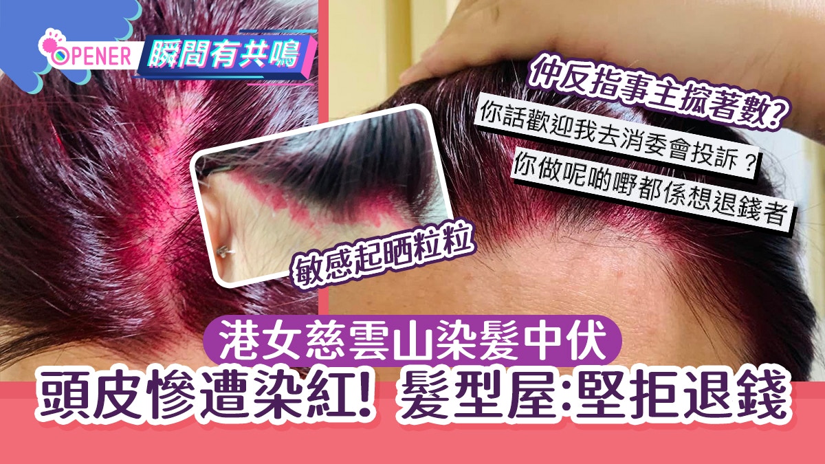港女染髮中伏！頭皮後頸慘遭染紅　髮型屋拒退錢＋指控事主搲著數