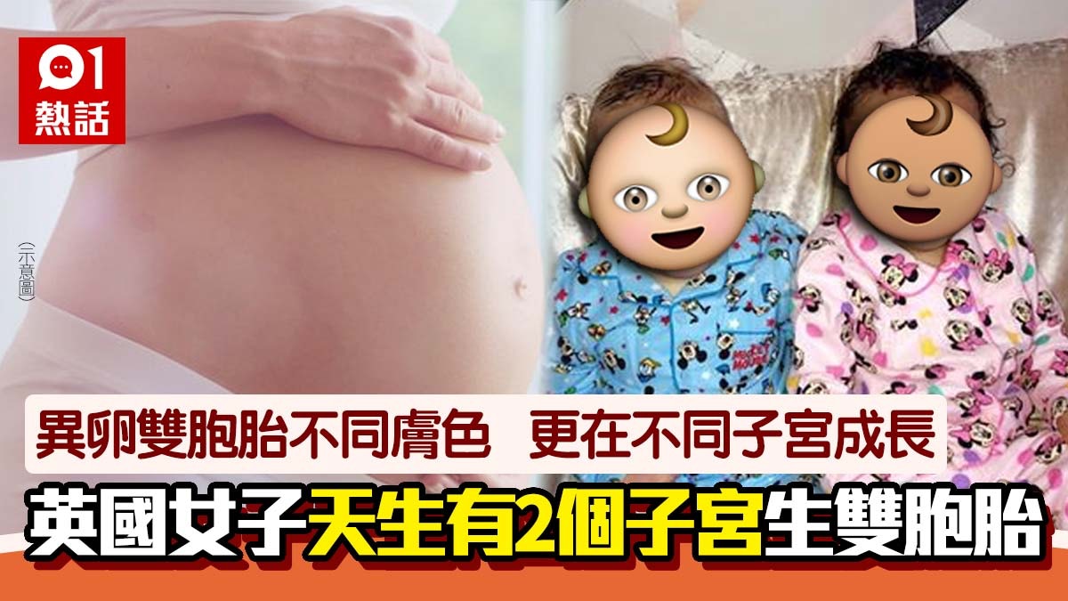 女子擁有雙子宮誕下不同膚色雙胞胎！醫生：機率是5000萬分之一