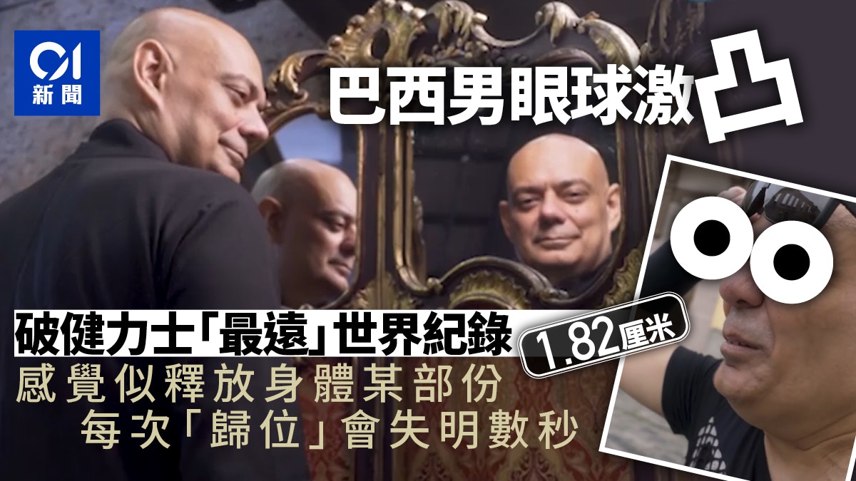打破「眼球凸出最遠」健力士世界紀錄　巴西男：上天的禮物