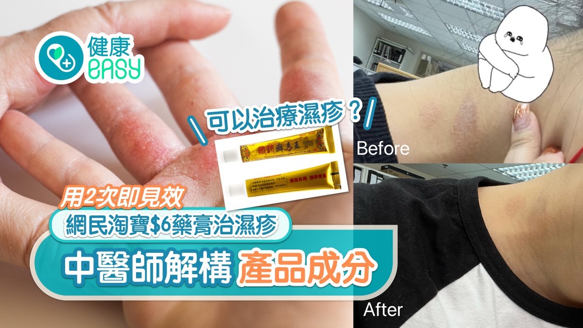 網民淘寶$6藥膏治濕疹用2次即見效中醫師解構產品成分 網民淘寶$6藥膏治濕疹用2次即見效中醫師解構產品成分