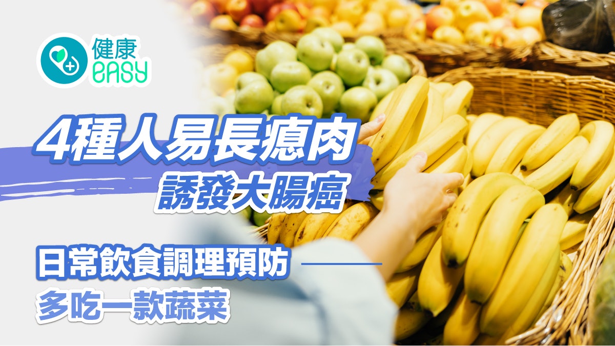 癌症|4種人易長瘜肉誘發大腸癌 日常飲食調理預防多吃一款蔬菜 癌症|4種人易長瘜肉誘發大腸癌 日常飲食調理預防多吃一款蔬菜