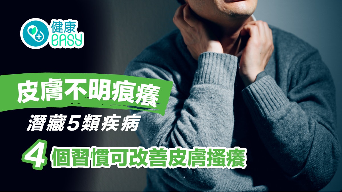 皮膚痕|皮膚不明痕癢潛藏5類疾病!養成這4個習慣改善皮膚搔癢 皮膚痕|皮膚不明痕癢潛藏5類疾病!養成這4個習慣改善皮膚搔癢
