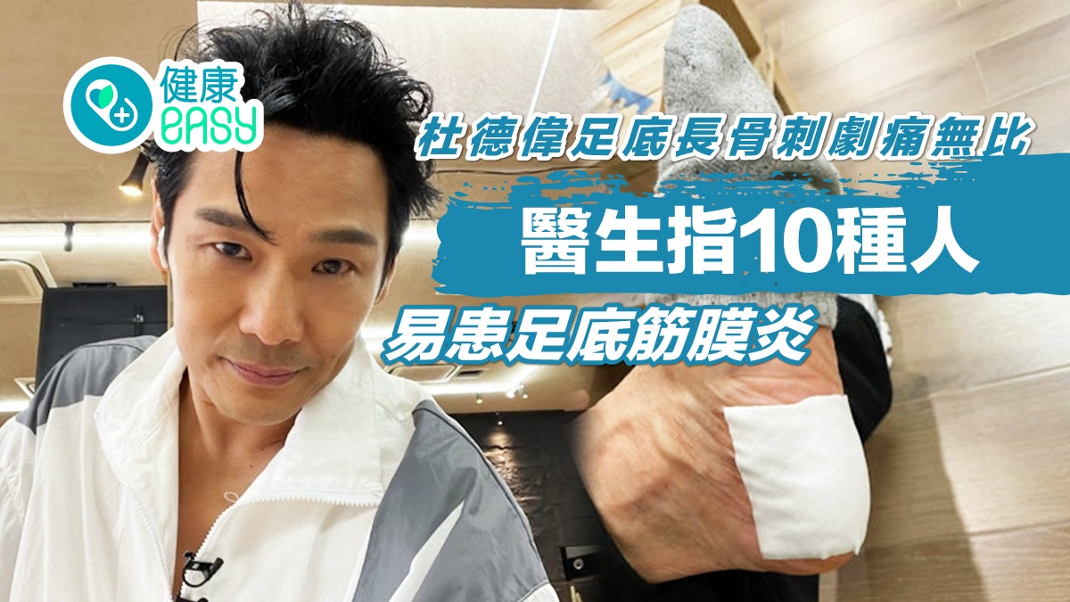 杜德偉足底長骨刺劇痛無比 醫揭10類高危人士做1運動預防最有效 杜德偉足底長骨刺劇痛無比 醫揭10類高危人士做1運動預防最有效