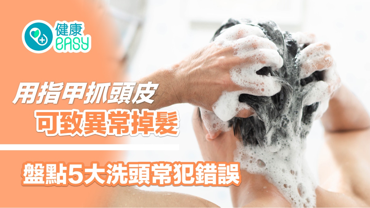 脫髮｜用指甲抓洗頭皮可致異常掉髮！盤點5大洗頭常犯錯誤