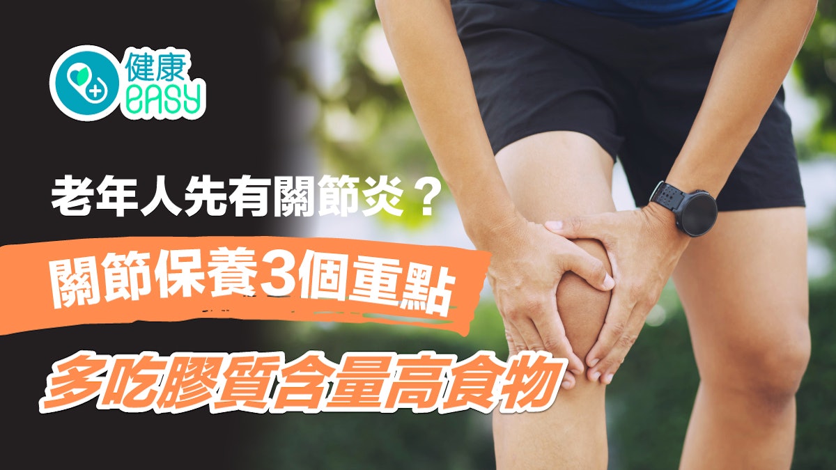 退化性關節炎|老年人先有關節炎?關節保養3要點多吃一類食物 退化性關節炎|老年人先有關節炎?關節保養3要點多吃一類食物