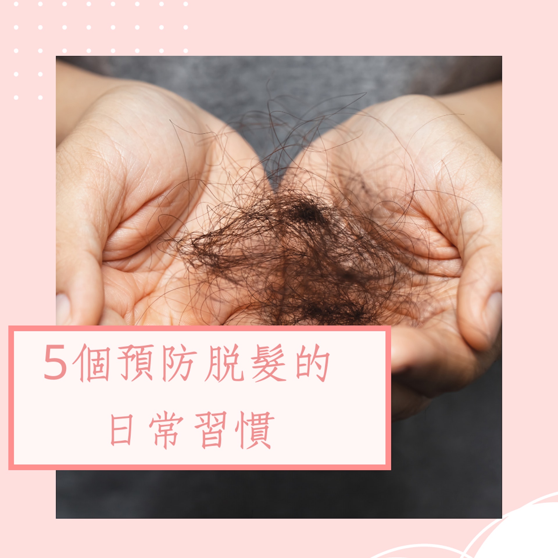 5個預防脫髮的日常習慣(01製圖) 5個預防脫髮的日常習慣(01製圖)
