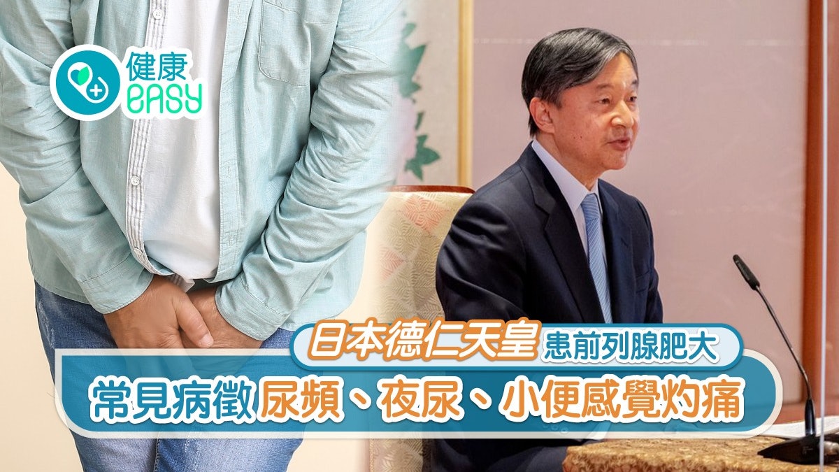 日本德仁天皇患前列腺肥大 常見病徵尿頻、夜尿、小便感覺灼痛 日本德仁天皇患前列腺肥大 常見病徵尿頻、夜尿、小便感覺灼痛