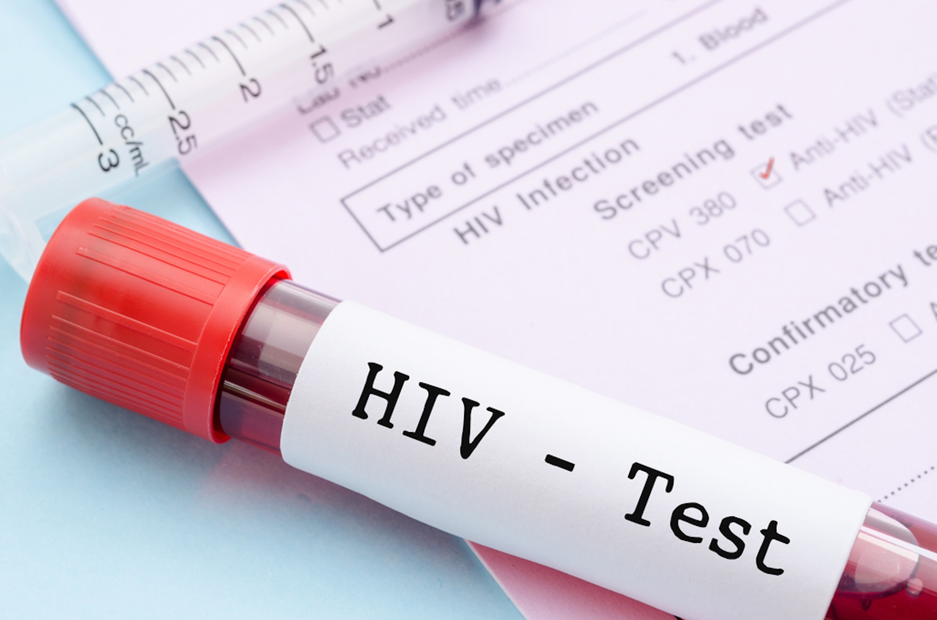 您需要進行愛滋病病毒檢查嗎？