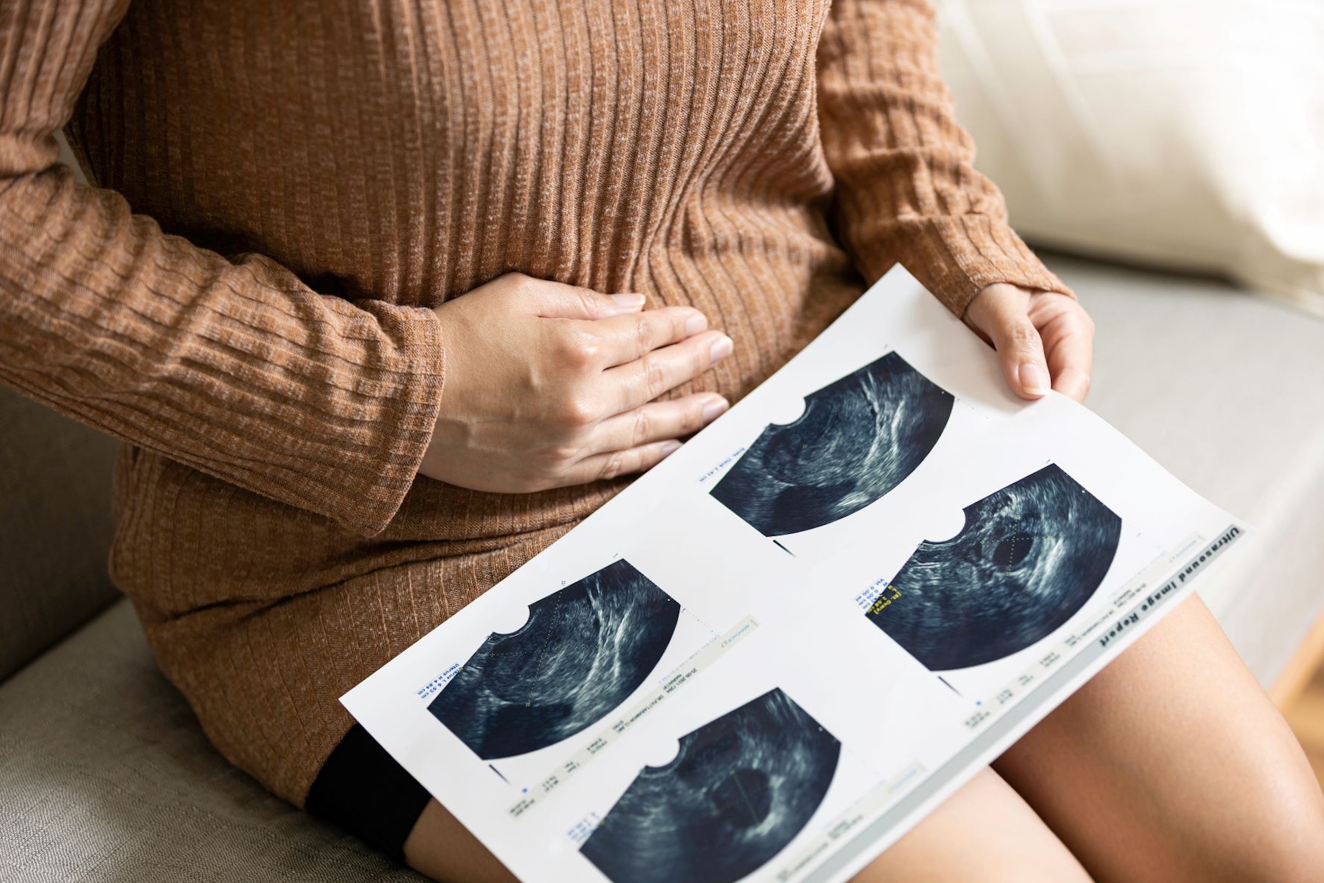 婦科良性腫瘤可分為不同種類；在中醫角度，病因多與痰濕、瘀血、氣滯有關。（圖片：Shutterstock）