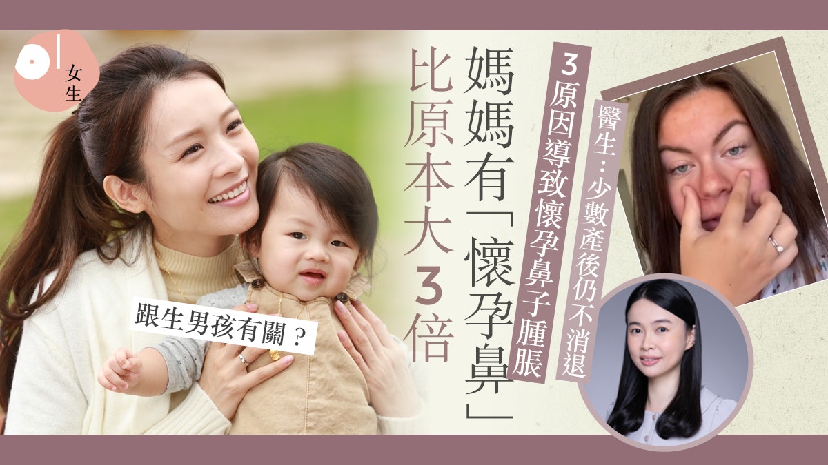 外國媽媽現「懷孕鼻」比平常大3倍!網民:生男孩才會變大 外國媽媽現「懷孕鼻」比平常大3倍!網民:生男孩才會變大