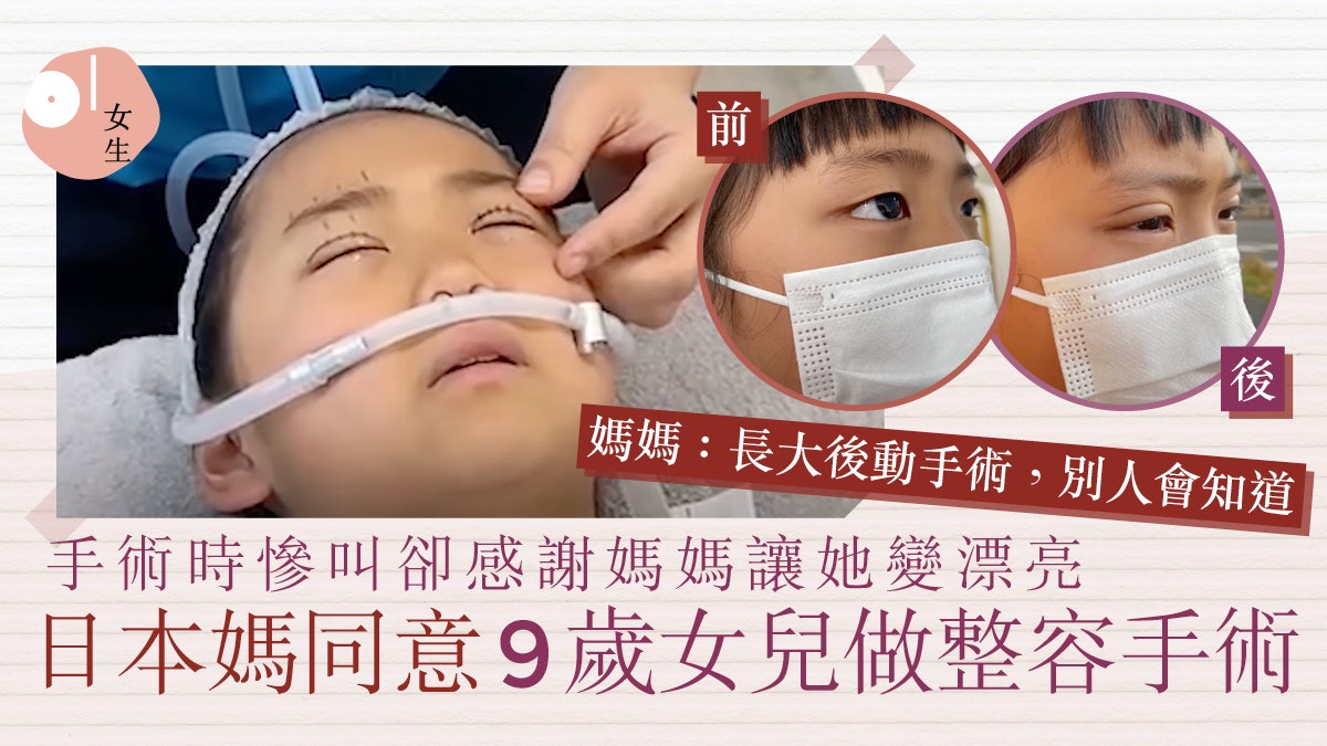 雙眼皮治好外貌焦慮?日本媽同意9歲女兒整容 只因自己的童年陰影 雙眼皮治好外貌焦慮?日本媽同意9歲女兒整容 只因自己的童年陰影