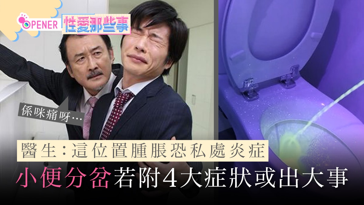 你小便會分岔嗎?醫生警告4個症狀有問題 這位置腫脹恐私處發炎 你小便會分岔嗎?醫生警告4個症狀有問題 這位置腫脹恐私處發炎