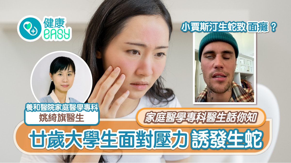 養和話你知|小賈斯汀生蛇致面癱?廿歲大學生面對壓力誘發生蛇 養和話你知|小賈斯汀生蛇致面癱?廿歲大學生面對壓力誘發生蛇