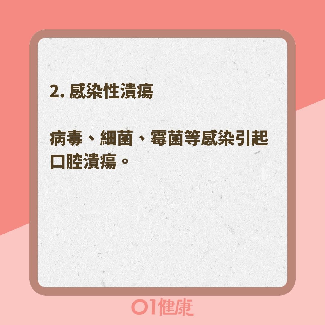 造成口腔潰瘍的原因有哪些？（01製圖 ）