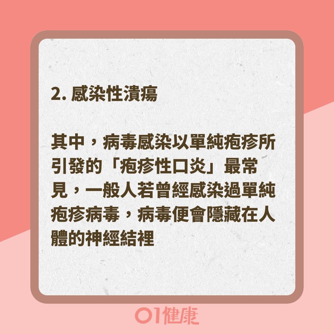 造成口腔潰瘍的原因有哪些？（01製圖 ）