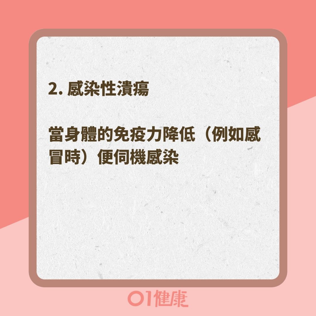 造成口腔潰瘍的原因有哪些？（01製圖 ）