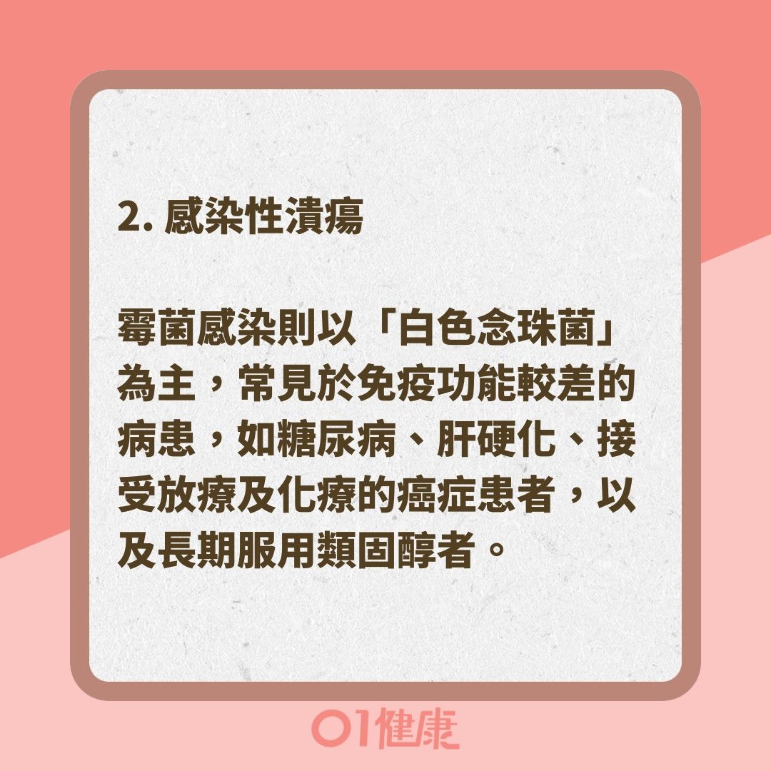 造成口腔潰瘍的原因有哪些？（01製圖 ）