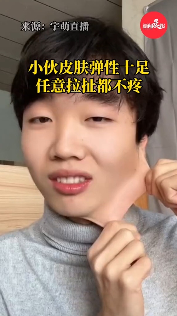 黑龍江哈爾濱一年輕男生16日自曝影片顯示，他臉部皮膚彈性十足，臉皮甚至能拉10公分，畫面相當驚悚。（宇萌直播影片截圖）